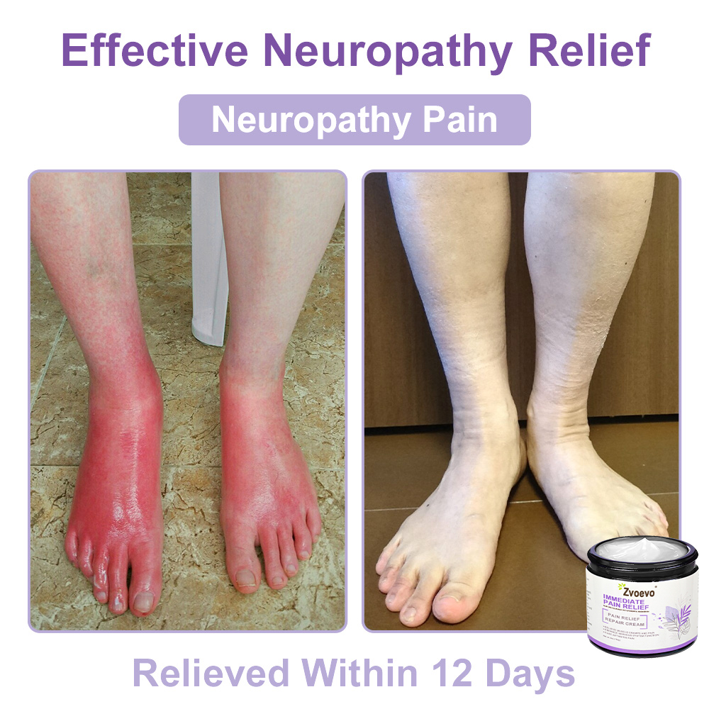 ✨ Zvoevo® Magnesium Pain Relief Cream – Powered by Natural Ingredients(Treatment for arthritis, neuropathyy, rheumatic diseases, muscle spasms, twitches and sports injuries)