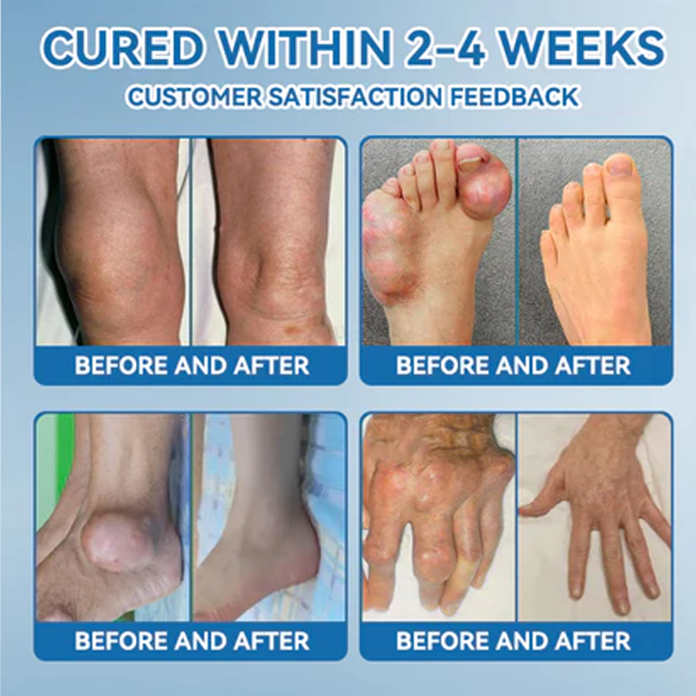 Zvo𝐞𝐯𝗼® BPC-157 Joint Healing Cream 🇺🇸 (🏅Treatment for arthritis, neuropathyy, rheumatic diseases, muscle spasms, sports injuries and twitches)