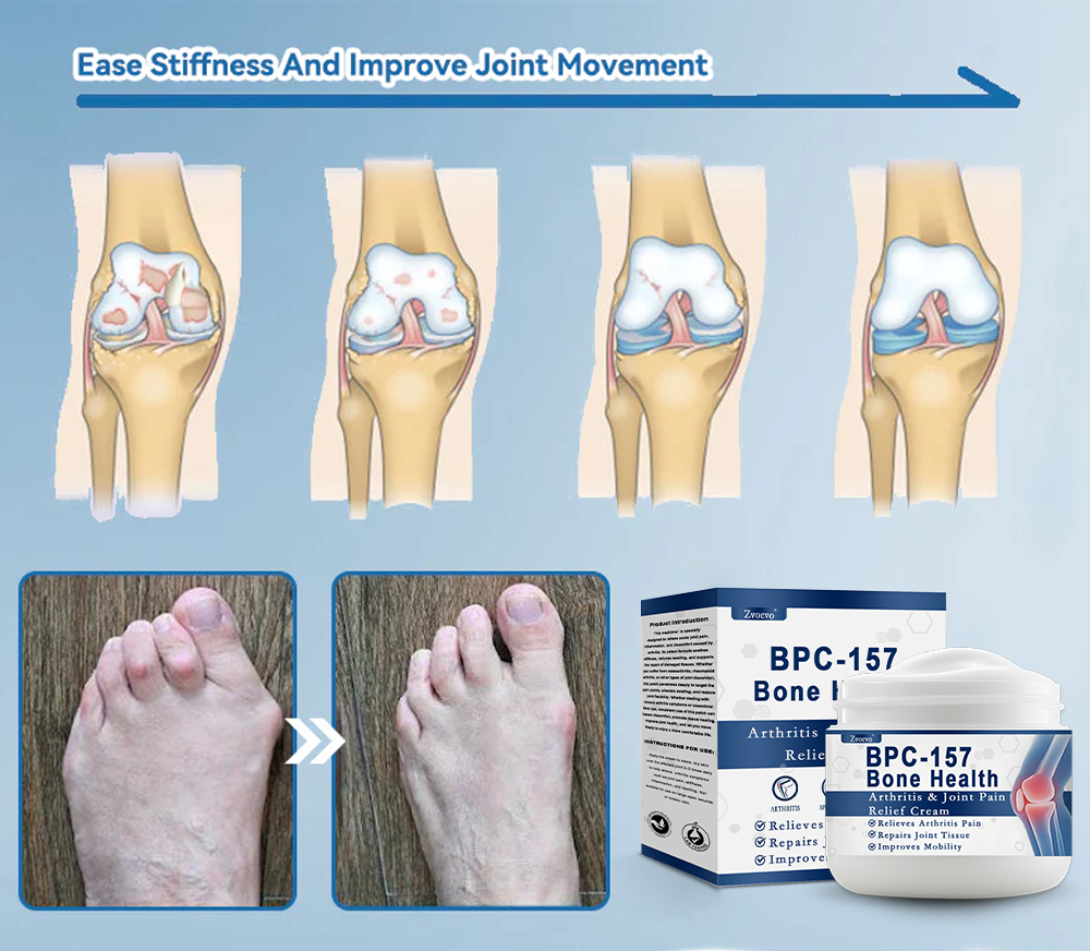 ✅Zvo𝐞𝐯𝗼® 𝗕𝖯𝖢-𝟏𝟓𝟕 Joint Healing Cream 👩‍⚕️ FDA-Certified ( 🇺🇸 Relief for Arthritis, Neuropathy, Sports Injuries & Rheumatism)