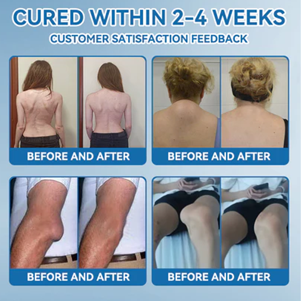 🇺🇸 Zvo𝐞𝐯𝗼® BPC-157 Joint Healing Cream (🏅Treatment for arthritis, neuropathyy, rheumatic diseases, muscle spasms, twitches and sports injuries)