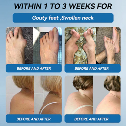 🇺🇸 Zvo𝐞𝐯𝗼® BPC-157 Joint Healing Cream (🏅Treatment for arthritis, neuropathyy, rheumatic diseases, muscle spasms, twitches and sports injuries)