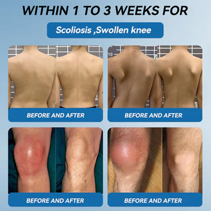 🇺🇸 Zvo𝐞𝐯𝗼® BPC-157 Joint Healing Cream (🏅Treatment for arthritis, neuropathyy, rheumatic diseases, muscle spasms, twitches and sports injuries)