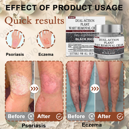 ✅ FDA Approved：Zvoevo® Rice Bran Extract Cream 👩‍⚕️ FDA-Certified (For removing warts and skin growths, eliminating skin hyperplasia and keratin buildup, treating skin cancer, age spots, and hyperpigmentation)