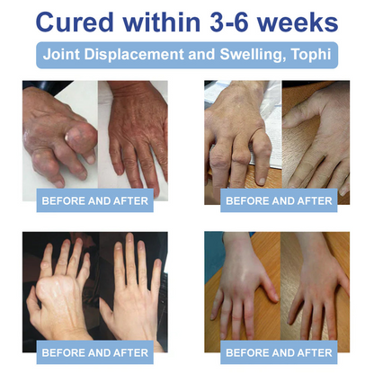 ✅FDA Certified :  Rekulo® Black Rice Pain Healing Bone Cream ( Treatment for arthritis, neuropathyy, rheumatic diseases, sports injuries, twitches and muscle spasms)