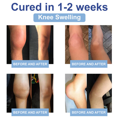 ✅Zvoevo® Magnesium Pain Healing Bone Cream (Effective relief for arthritis, nerve pain, rheumatic conditions, muscle spasms, and sports injuries)